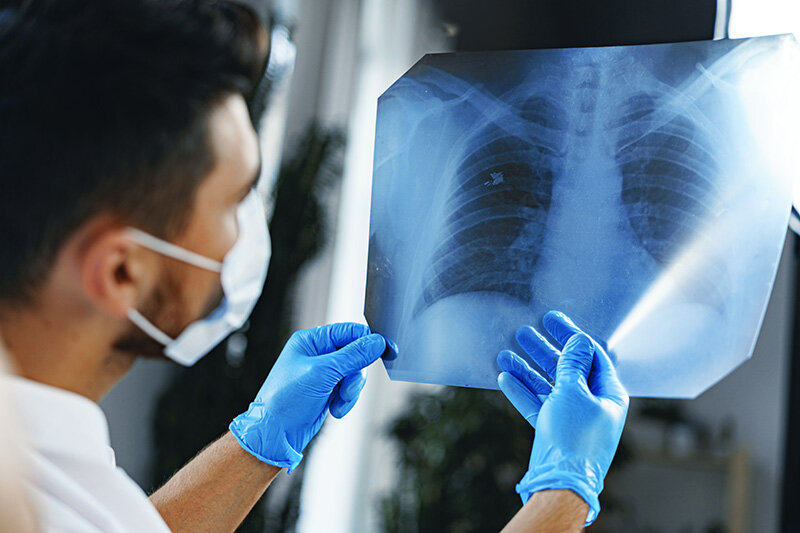 Un médico observa los pulmones (Foto: envato)