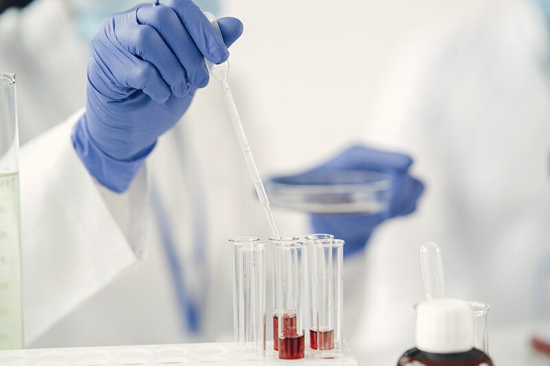 Muestras de laboratorio para identificar sospechas (Foto: envato)